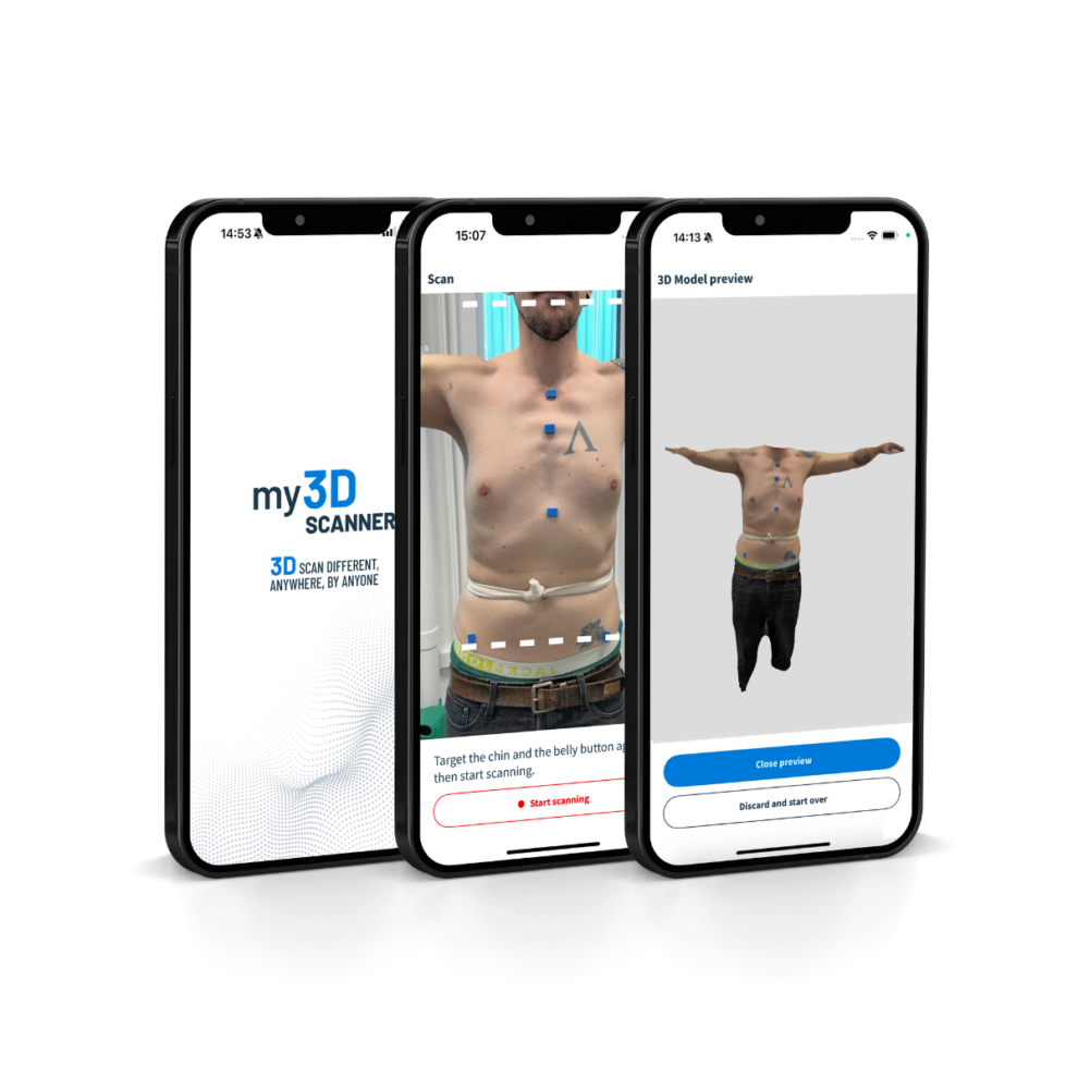 Utilisation du scan 3D en orthopédie