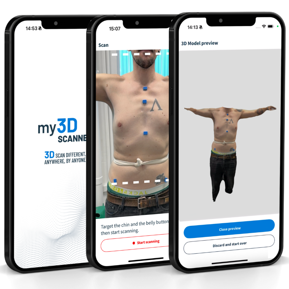 The Use of 3D Scanning in Orthopedics