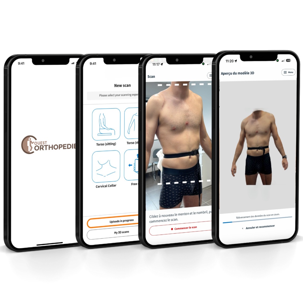 3D mobile scanning for custom-made braces